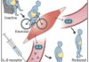 How the physical activity can reduces belly fat in humans