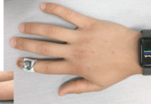 IBM : A tiny fingernail sensor has been worked up that monitors diseases and movement disorders