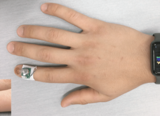 IBM : A tiny fingernail sensor has been worked up that monitors diseases and movement disorders