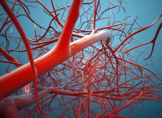 Kidney dialysis can cause short-term cerebral stunning and may be associated with progressive brain injury