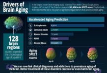 Largest brain study identifies drivers of brain aging