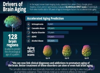 Largest brain study identifies drivers of brain aging