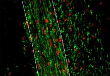 New research on remyelination could lead to a novel approach to developing treatments for multiple sclerosis (MS)
