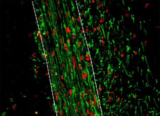 New research on remyelination could lead to a novel approach to developing treatments for multiple sclerosis (MS)