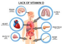 Newborns with vitamin D deficiency have an increased risk of schizophrenia later in life
