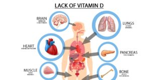 Newborns with vitamin D deficiency have an increased risk of schizophrenia later in life