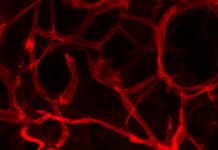 New research shows that inhibiting a protein within blood vessels stimulates new blood vessel growth, resulting in healthier fat tissue (adipose) and lower blood sugar levels