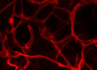 New research shows that inhibiting a protein within blood vessels stimulates new blood vessel growth, resulting in healthier fat tissue (adipose) and lower blood sugar levels