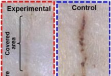Researchers have developed a self-powered bandage that generates an electric field over an injury, dramatically reducing the healing time for skin wounds