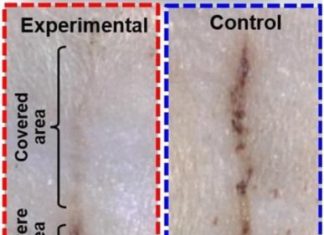Researchers have developed a self-powered bandage that generates an electric field over an injury, dramatically reducing the healing time for skin wounds