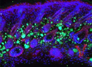 Researchers have discovered how the skin loses the ability to form fat during aging