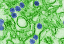 Researchers may have identified a vaccine that would defend against Zika virus without producing antibodies