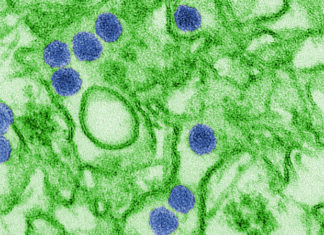 Researchers may have identified a vaccine that would defend against Zika virus without producing antibodies