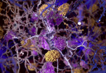 Some neurons in the brain protect themselves from Alzheimer’s with a cellular cleaning system that sweeps away toxic proteins associated with the disease