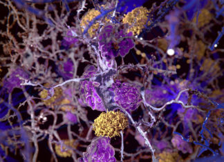Some neurons in the brain protect themselves from Alzheimer’s with a cellular cleaning system that sweeps away toxic proteins associated with the disease