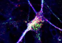 Stem cell-derived neurons stop seizures and improve cognitive function