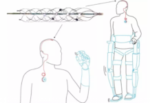 Researchers have developed a tiny device that electrically stimulates the brain to treat conditions such as epilepsy and Parkinson’s disease without invasive surgery
