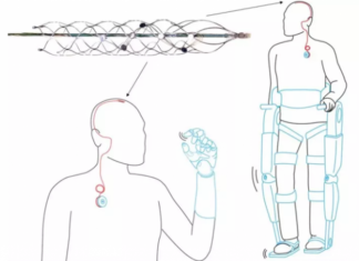 Researchers have developed a tiny device that electrically stimulates the brain to treat conditions such as epilepsy and Parkinson’s disease without invasive surgery