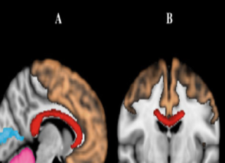 Stressful or traumatic experiences occurring in a child’s earliest years have been linked to reduced hippocampal volume in adolescence