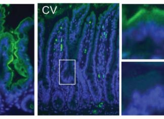 The gut microbiome regulates the host’s immune system