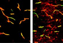 Through study of fatty acids revealed new Parkinson’s disease drug