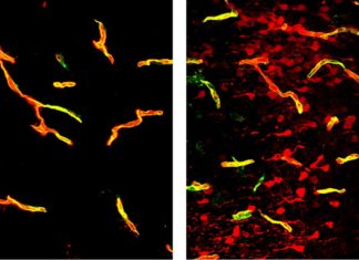 Through study of fatty acids revealed new Parkinson’s disease drug