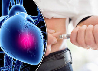 Two drugs commonly prescribed to treat Type 2 diabetes carry a high risk of cardiovascular events such as heart attack, stroke, heart failure or amputation