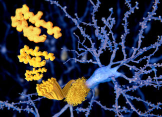 Combining low doses of a toxic herbicide with sugar-binding proteins called lectins may trigger Parkinsonism