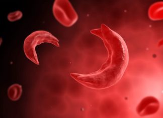 A daily hydroxyurea pill may finally bring some relief for young children living with the painful and deadly blood disease sickle cell anemia (SCA)