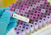 HIV vaccine: experimental vaccine strategy works in non-human primates