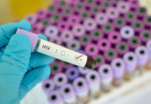 HIV vaccine: experimental vaccine strategy works in non-human primates