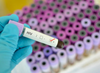 HIV vaccine: experimental vaccine strategy works in non-human primates