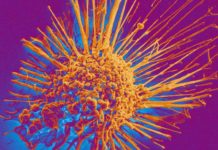 A widely used diabetes medication combined with an antihypertensive drug specifically inhibits tumor growth