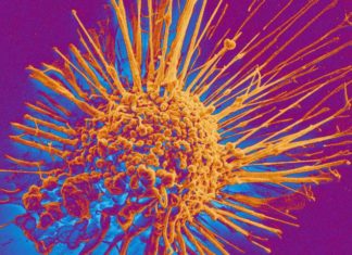 A widely used diabetes medication combined with an antihypertensive drug specifically inhibits tumor growth