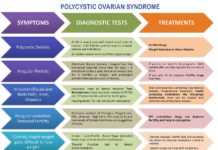 Polycystic ovary syndrome : Researchers identify genes