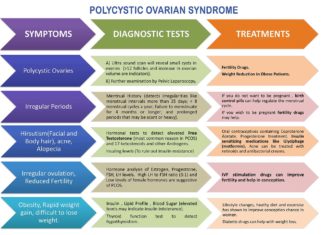 Polycystic ovary syndrome : Researchers identify genes