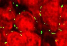 Researchers uncovered a possible explanation for how marijuana damage the brains of teens