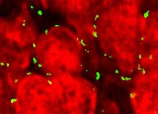 Researchers uncovered a possible explanation for how marijuana damage the brains of teens
