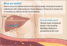Thousands of heart attacks and deaths from cardiovascular disease could be prevented by patients taking higher doses of statins