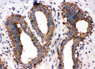 Chaos in bodily regulation can optimize our immune system