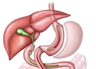 Researchers report bile acids play a key role in providing positive metabolic effects after weight loss surgery
