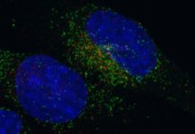 Fusion genes are found in some types of cancer – they can be studied for the diagnosis and treatment of these diseases