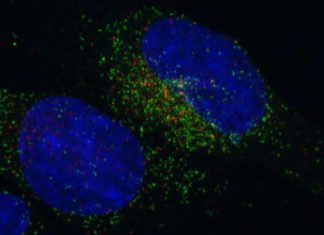 Fusion genes are found in some types of cancer – they can be studied for the diagnosis and treatment of these diseases