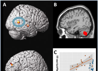Cerebellum plays a major role in reward processing and social behaviors