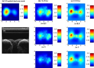 Novel noninvasive imaging technique could help radiologists differentiate cancer from benign tumors