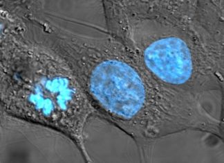 Eosinophils may be used to eliminate malignant colon cancer cells
