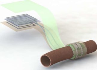 Researchers create a wireless, battery-free, biodegradable blood flow sensor that doesn’t need to be removed