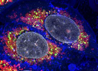 Researchers have unlocked a key process that contributes to diseases