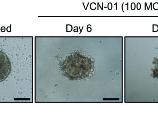 Retinoblastoma : Genetically modified virus is able to kill tumor