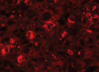Scientists have developed a gene therapy that blocks peripheral nerve damage